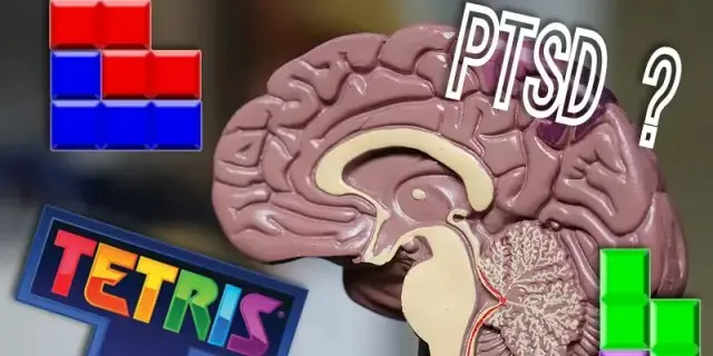 งานวิจัย Oxford เกี่ยวกับ Tetris และ PTSD